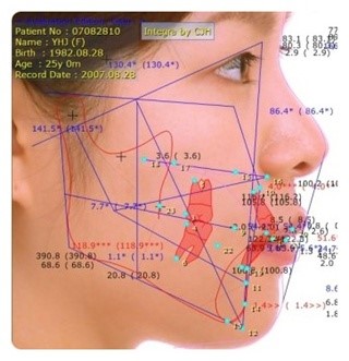 치아교정 궁금증 해결 – 그것이 알고 싶다 관련 이미지 2