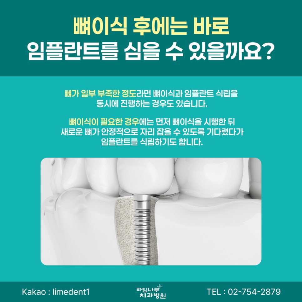 명동 임플란트, 임플란트 뼈이식은 어떤 경우에 필요할까요? 관련 이미지 6