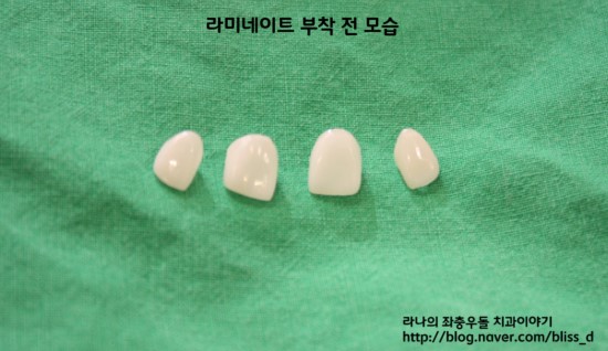 한 눈에 보는 라미네이트 : 라미네이트의 탄생과정 관련 이미지 4