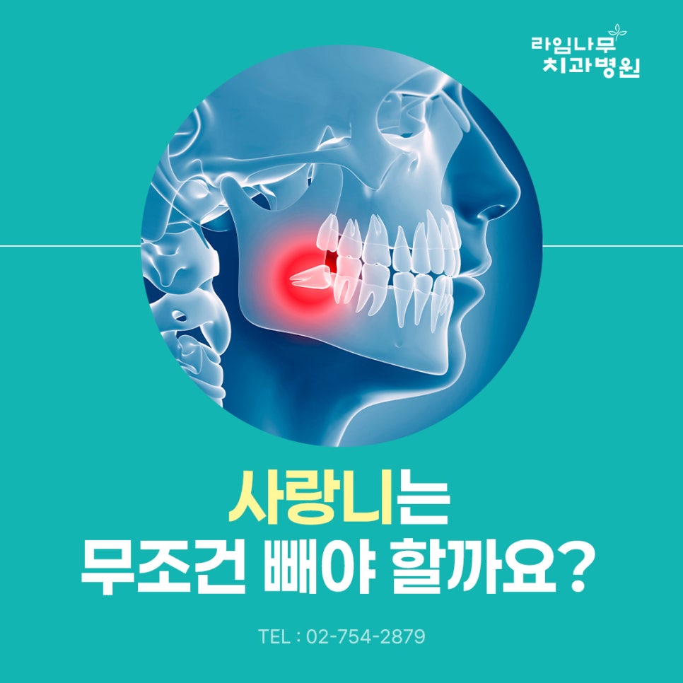 명동 치과 사랑니는 무조건 빼야 할까요? 발치가 필요한 경우 알아보기 관련 이미지 2