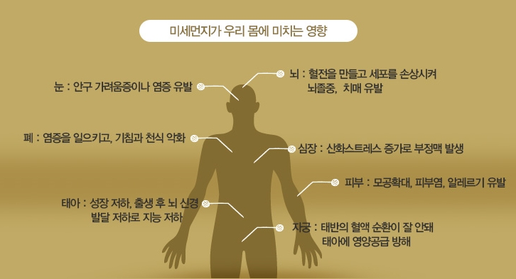 [명동치과]미세먼지에 좋은 음식, 어떤 것들이 있는지 알아봐요 관련 이미지 2
