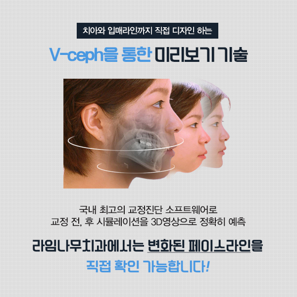 라임나무치과에서 남모르게 투명교정 시작하자 관련 이미지 4