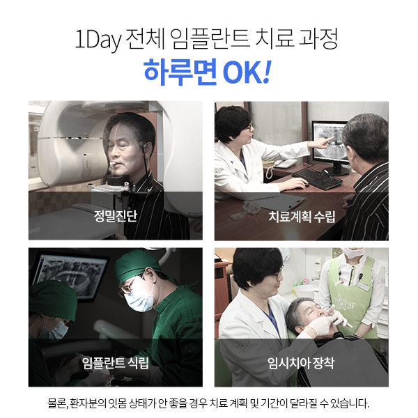 임플란트 4개 식립시간, 과연 얼마나 걸릴까?? 관련 이미지 2
