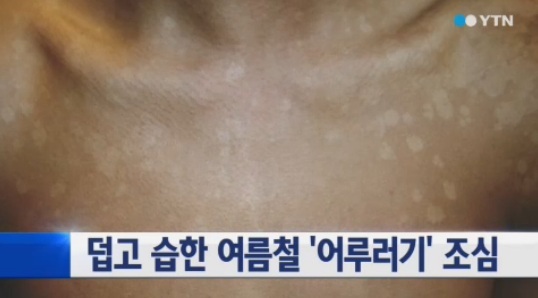 [명동치과 라임나무]장마철 곰팡이 제거방법, 무턱대고 창문 열지 마세요 관련 이미지 5