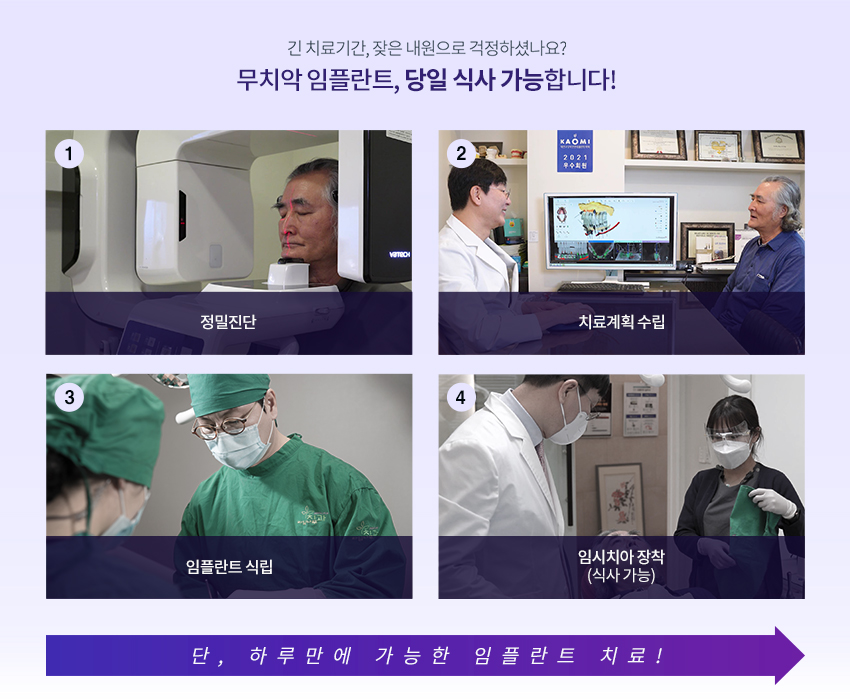 [라임나무치과]네비게이션 원리 임플란트, 실제 사례를 통해 알아봤습니다. 관련 이미지 6