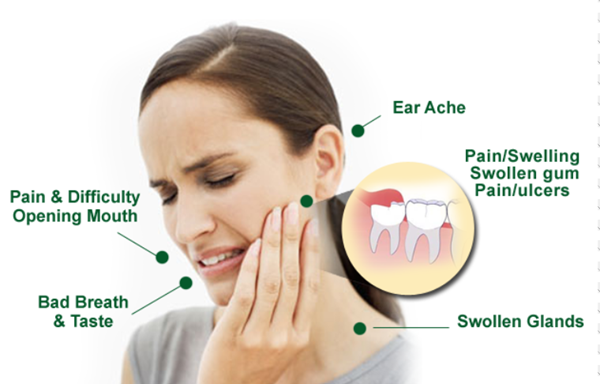 사랑니 발치에 대한 궁금증, 라나가 시원하게 해결해 드립니다 관련 이미지 7