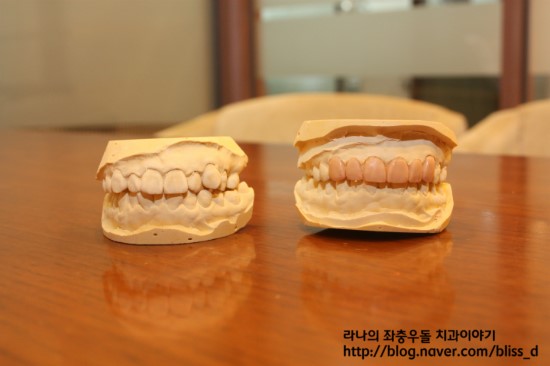 한 눈에 보는 라미네이트 : 라미네이트의 원리 관련 이미지 3