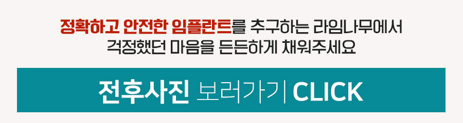 임플란트로 상실한 치아 고민 해결해 보세요 관련 이미지 9