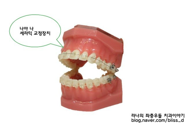 학생교정시 고려할 점은 무엇일까? 관련 이미지 1