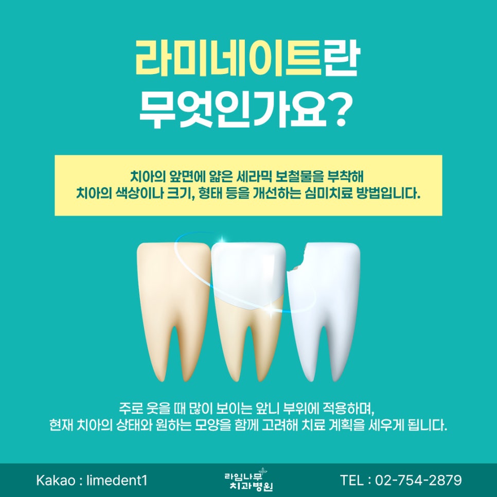 명동 라미네이트 앞니 모양이 고민이라면? 라미네이트로 개선할 수 있는 경우 관련 이미지 3