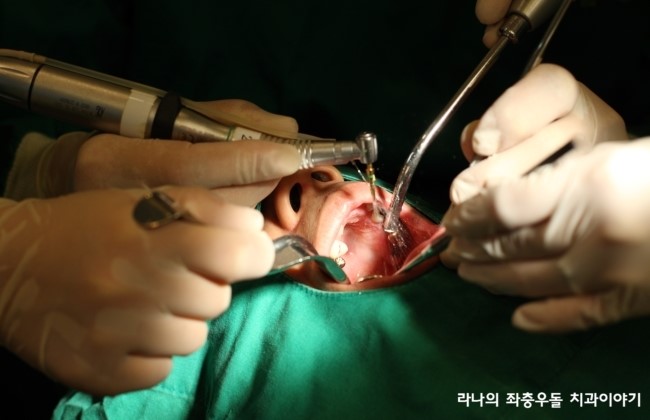 라나의 임플란트 이야기 - 임플란트 시술과정이 궁금해요. 관련 이미지 7