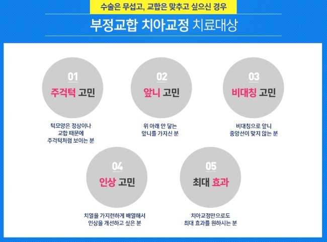 부정교합 고민 치아교정으로 해결하세요 관련 이미지 4