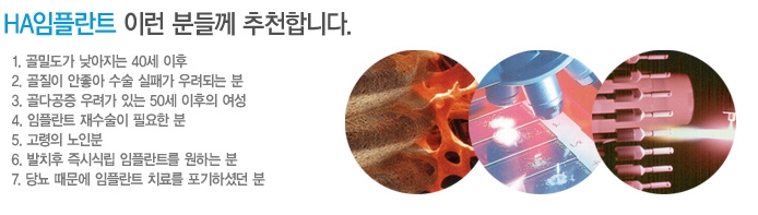 임플란트 고민, 잇몸뼈 재생 촉진하는 HA임플란트로 해결하세요 관련 이미지 5