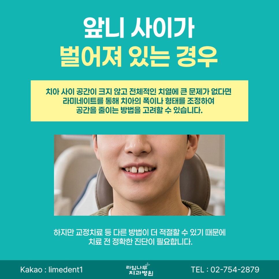 명동 라미네이트 앞니 모양이 고민이라면? 라미네이트로 개선할 수 있는 경우 관련 이미지 4