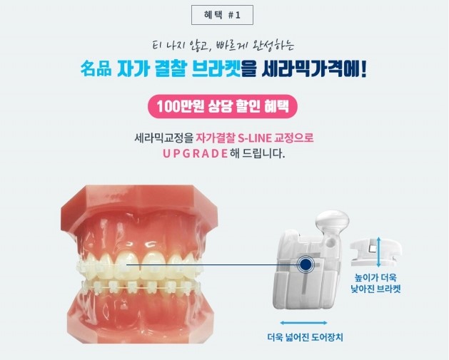 라임나무치과 홈페이지 리뉴얼 기념 [이벤트] 관련 이미지 2