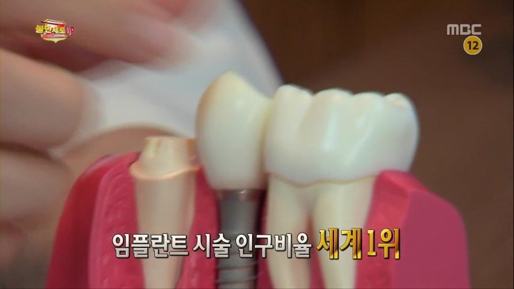 불만제로UP 28화 임플란트 부작용 나 몰라라! 임플란트 가격은 부르는 데로! 관련 이미지 2