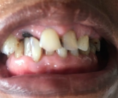 2015 라임나무치과병원 캄보디아 의료봉사 후기를 공개합니다 관련 이미지 8