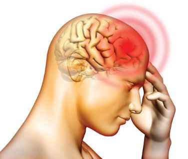 [명동치과]뇌졸중 전조증상, 환절기에 위험한 뇌졸중 알아봤어요 관련 이미지 1