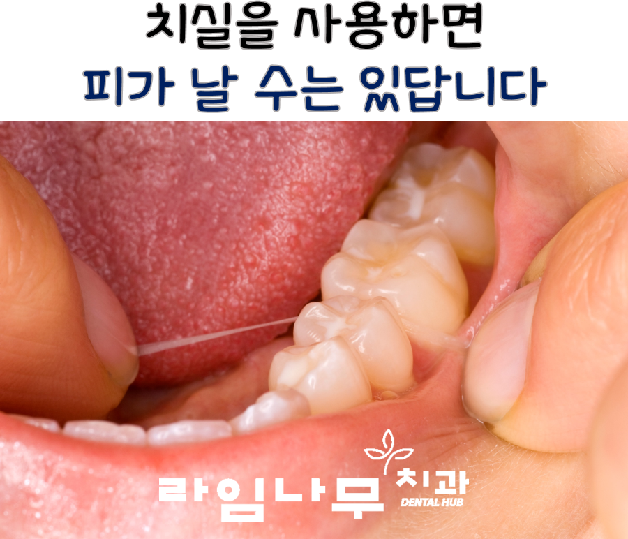 치실! 잇몸 피나는데 계속 사용해도 될까요? 명동치과 관련 이미지 2
