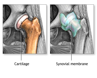 임플란트 수명 과연 얼마나 될까? 관련 이미지 2