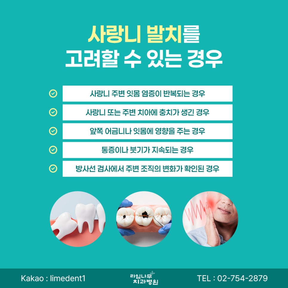 명동 치과 사랑니는 무조건 빼야 할까요? 발치가 필요한 경우 알아보기 관련 이미지 4