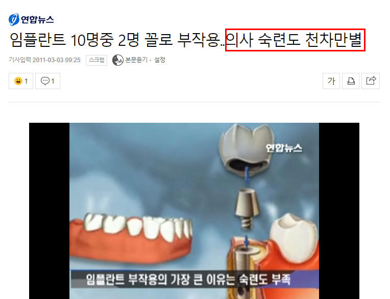 싼게 비지떡? 실패한 임플란트? NO! 라임나무치과병원 OK 관련 이미지 4