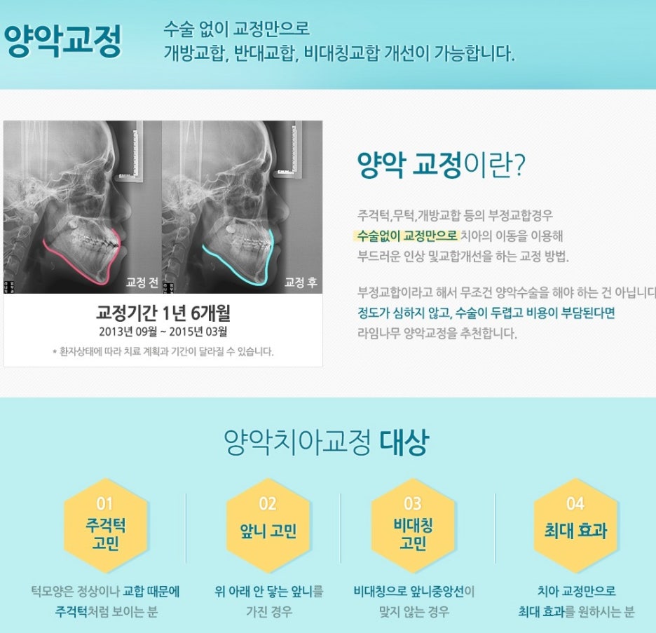 [명동치과]돌출입 때문에 고민중이시라고요? 라임나무에서 교정하세요 관련 이미지 6