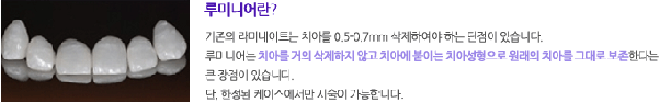 승무원들에게 라미네이트를 추천하는 이유? 관련 이미지 8