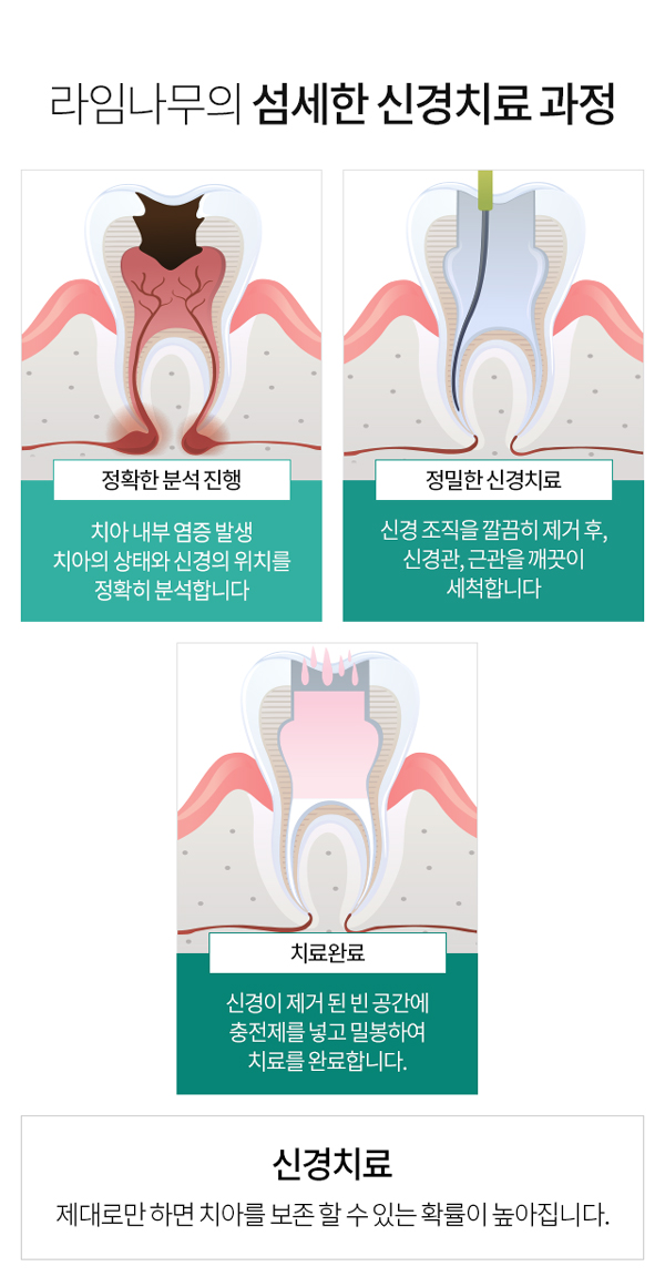 신경치료보다 더힘든 재신경치료, 치과선택은? 관련 이미지 3