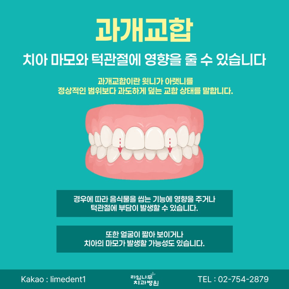 치아교정 시작 전, 알아둬야 할 체크포인트 관련 이미지 5