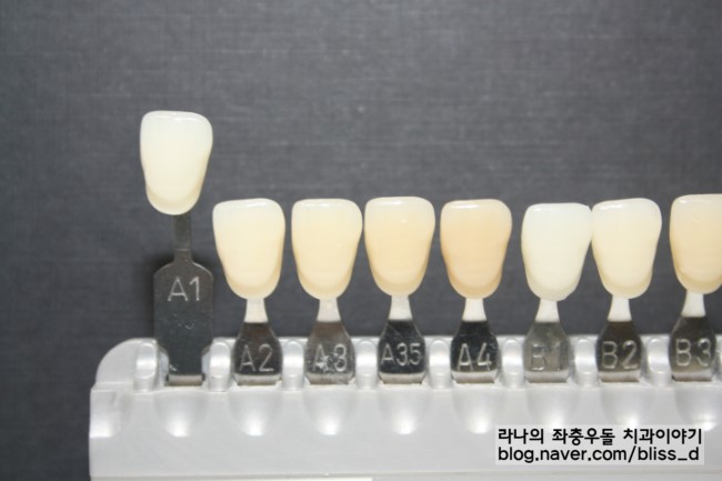 라미네이트 부작용 궁금하신가요? 관련 이미지 2