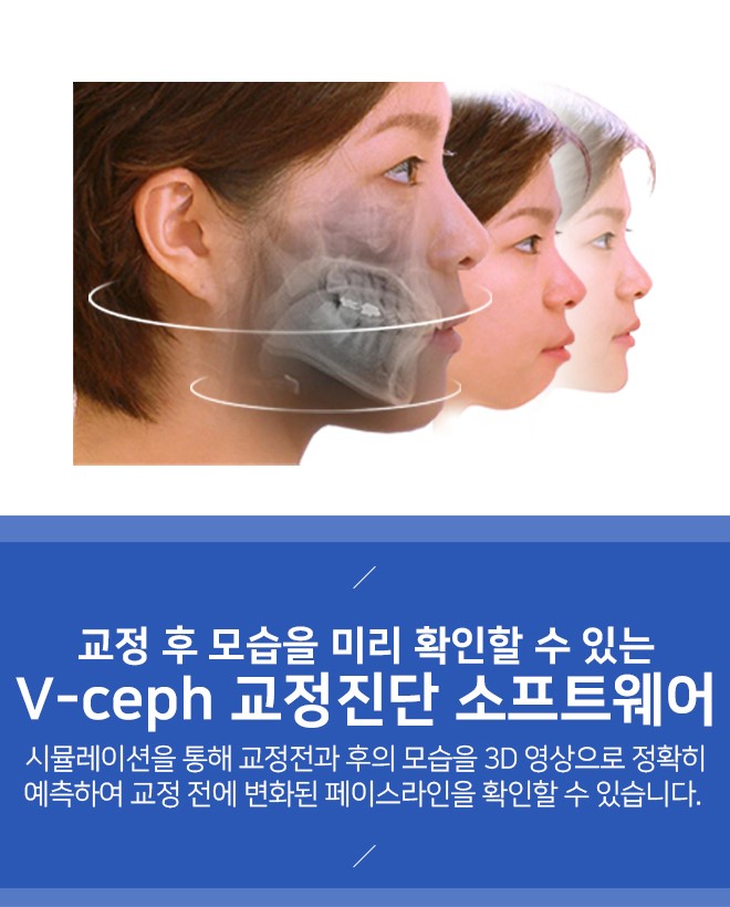 명동치과 치아교정 알아보고 계셨다면? 관련 이미지 4