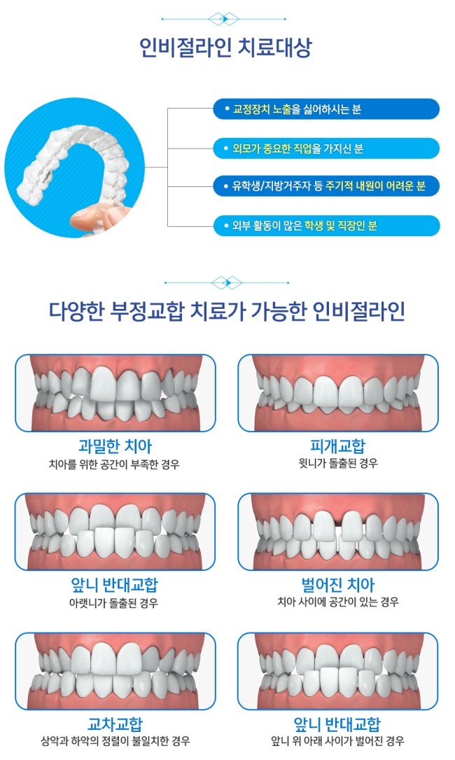 투명교정 인비절라인으로 티 안나게 교정하세요 관련 이미지 7