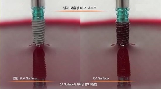 성공적인 임플란트를 위한 표면처리 기술 얼마나 알고 계신가요? 관련 이미지 4