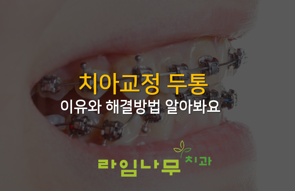 치아교정 두통, 명동치과 라임나무와 알아봐요! 관련 이미지 1