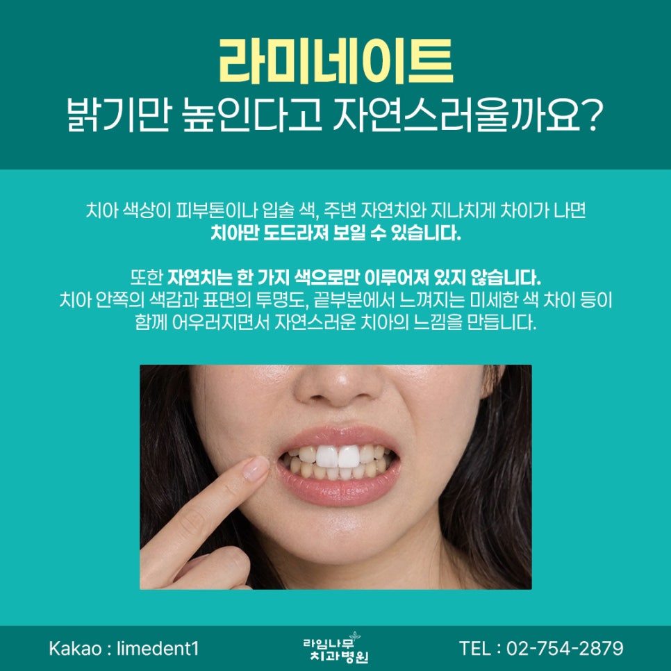 명동 라미네이트 전 꼭 확인해야 할 자연스러운 치아 디자인 기준 관련 이미지 3