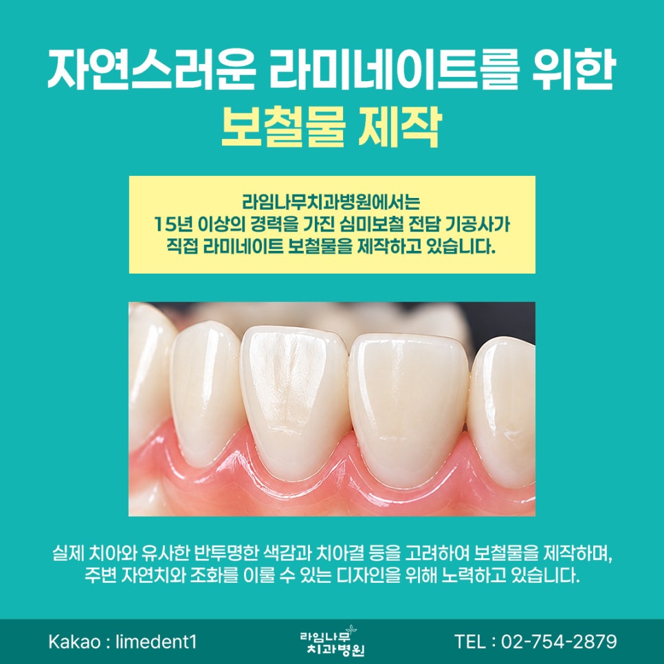 라미네이트 치료, 신중한 결정이 중요합니다 관련 이미지 5