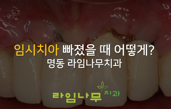 임시치아 빠짐, 빠졌을 때 어떻게? 명동 라임나무치과 관련 이미지 1