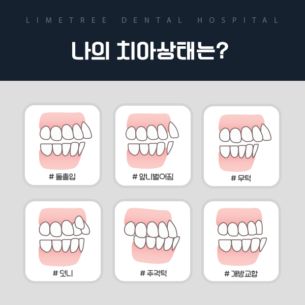 부담없이 치아교정기간을 소화하려면? 관련 이미지 3