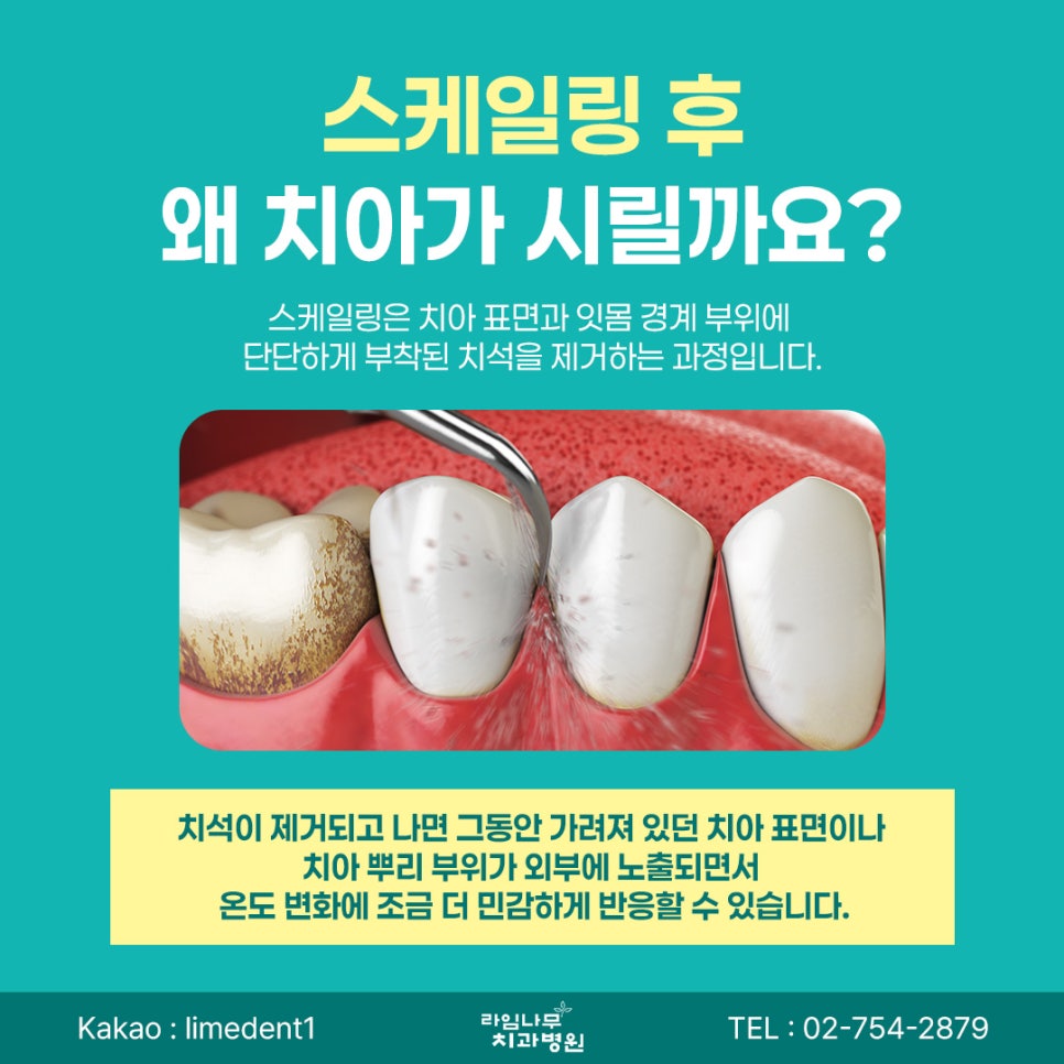 Why Your Teeth May Feel Sensitive After Scaling at a Myeongdong Dental Clinic and How to Care for Them image 3