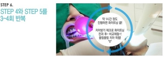 한 눈에 보는 치아미백 Vol2 - 치아미백 치료방법 관련 이미지 8