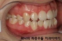 학생교정시 고려할 점은 무엇일까? 관련 이미지 4