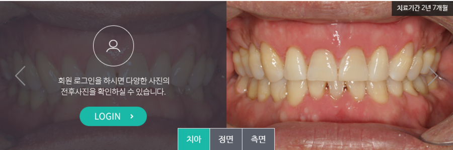 [명동 역삼 라임나무치과] 치아교정, 이런 분들께 꼭 필요해요! 관련 이미지 9