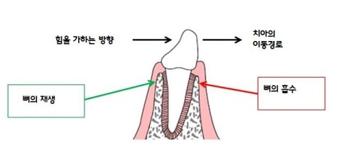 한 눈에 보는 치아교정 이야기 - 치아교정의 역사 관련 이미지 7