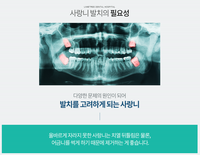 사랑니 발치 후유증 드라이 소켓이란? [라임나무치과] 관련 이미지 2