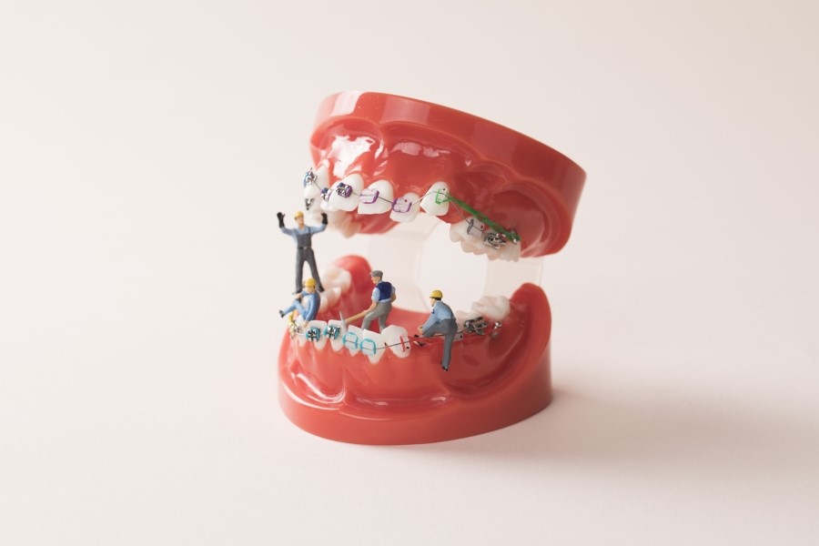 [명동 역삼 라임나무치과] 치아교정, 이런 분들께 꼭 필요해요! 관련 이미지 6