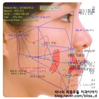 치아교정 가격 보다 치아교정 잘하는 치과 고르기 관련 이미지 3