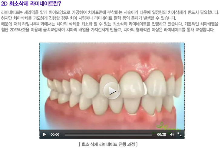 승무원들에게 라미네이트를 추천하는 이유? 관련 이미지 7