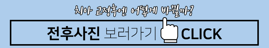 치아교정 시작 전, 알아둬야 할 체크포인트 관련 이미지 9