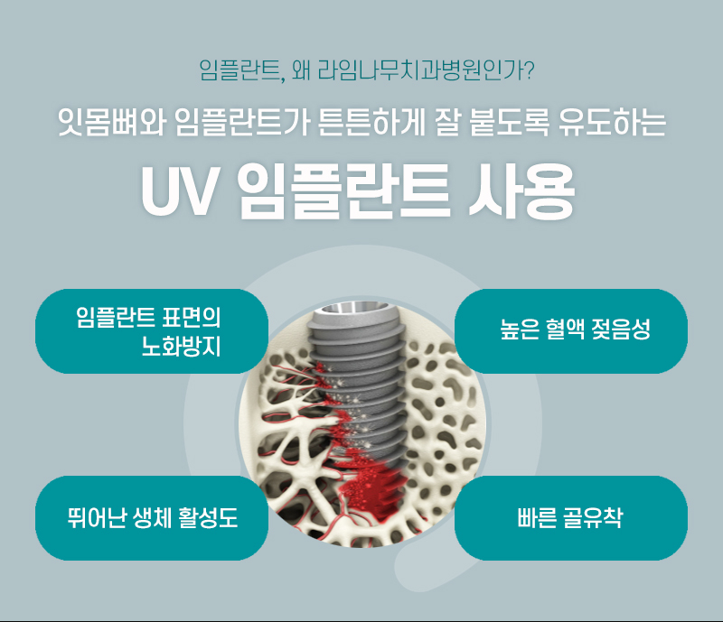 임플란트로 상실한 치아 고민 해결해 보세요 관련 이미지 5